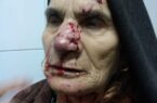 گرگ ۲ شهروند هشجین خلخال را راهی بیمارستان کرد
