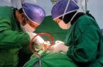 نجات زن ۵۴ ساله پارس آبادی با عمل جراحی خارج کردن تومور خطرناک در ناحیه نخاع