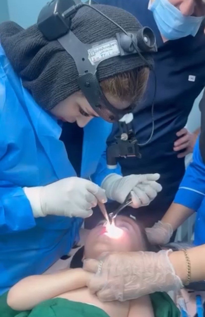 خارج کردن مروارید سیاه از داخل بینی کودک دو ساله در بیمارستان فاطمی اردبیل + فیلم خارج کردن مروارید سیاه از داخل بینی کودک دو ساله در بیمارستان فاطمی اردبیل + فیلم